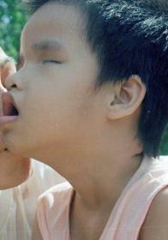 Nhật Bản hỗ trợ Việt Nam điều trị bệnh liên quan tới chất độc da cam/dioxin