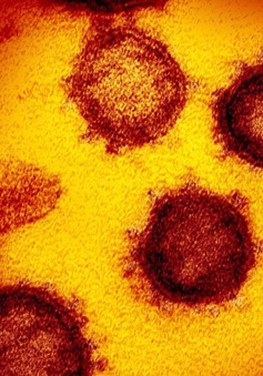 Virus SARS-CoV-2 tồn tại trên da người trong 9 giờ đồng hồ
