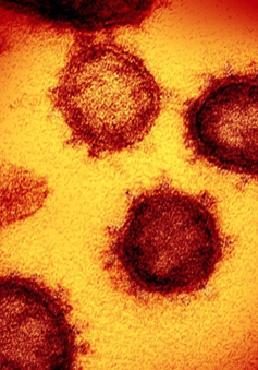 Virus Corona mới dễ gắn kết với tế bào người hơn SARS gấp 20 lần
