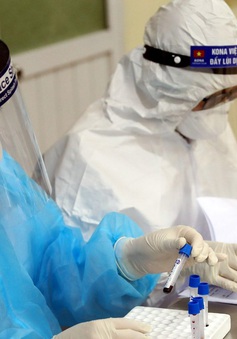 Bộ Y tế yêu cầu các bệnh viện báo cáo về việc triển khai xét nghiệm SARS-CoV-2