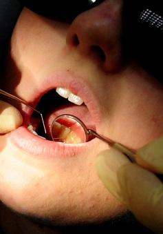 Lười đánh răng, coi chừng nguy cơ ung thư miệng và dạ dày