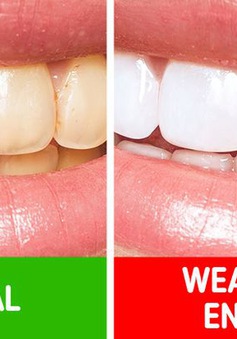 10 bí quyết chăm sóc răng miệng giúp bạn không bao giờ phải gặp nha sĩ