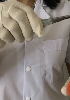 Yên Bái: Phát hiện 1 bệnh nhân nhiễm giun rồng