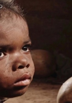 Đói nghèo cùng cực, nhiều người dân Madagascar phải ăn những miếng da giày