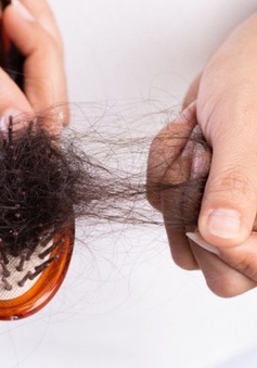 Rụng tóc - dấu hiệu cảnh báo sức khỏe đang gặp vấn đề