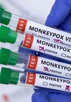 Mỹ xác nhận 9 trường hợp mắc đậu mùa khỉ ở 7 bang