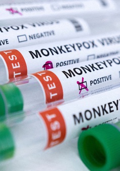Châu Phi cần bộ xét nghiệm, vaccine trong bối cảnh bệnh đậu mùa khỉ lây lan