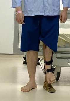 Kỳ tích mới: Kéo dài chân tới... 18 cm cho chàng trai mắc dị tật chân cao chân thấp