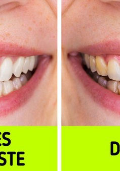 6 sai lầm khi đánh răng khiến bạn không thể có "nụ cười tỏa sáng"