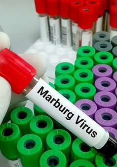 Bùng phát virus Marburg gây tử vong cao ở Tanzania