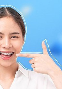 Nha khoa Peace Dentistry lưu ý về độ tuổi niềng răng phù hợp