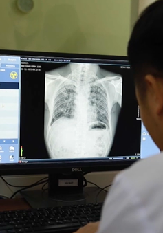 Nghệ An: Phát hiện thêm nhiều công nhân mắc bệnh bụi phổi
