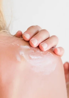 18 nguy cơ tổn hại sức khỏe khi làn da bị cháy nắng