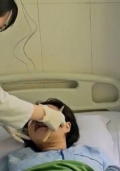 Nổ bình gas mini, một người bị đa chấn thương vùng mặt