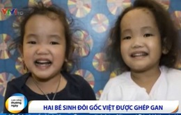 Canada: Hai bé sinh đôi gốc Việt được ghép gan
