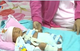 Sở Y tế An Giang đưa ra kết luận nguyên nhân trẻ sơ sinh bị gãy xương đùi