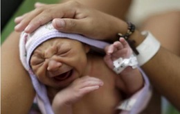 Một phụ nữ Mexico nhiễm virus Zika sinh con khỏe mạnh