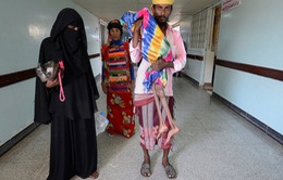 Hơn 14 triệu người Yemen bị thiếu lương thực trầm trọng
