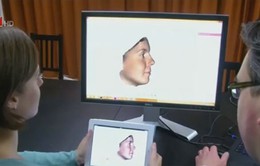 Công nghệ 3D giúp phẫu thuật mũi chính xác hơn
