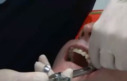Anh: Người dân tự nhổ răng ở nhà vì không có điều kiện đến nha sĩ
