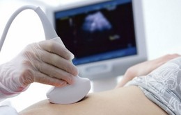 Ý kiến trái chiều về dự luật cấm nạo phá thai mới tại Ba Lan