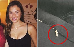Khách hàng kiện Zara sau khi phát hiện chuột chết trong váy