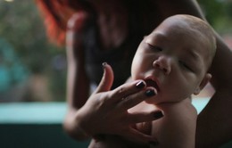 Bộ Y tế vào Đăk Lăk đánh giá trường hợp bé 4 tháng tuổi nghi mắc chứng đầu nhỏ