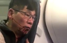 United Airlines hoàn tiền cho tất cả hành khách trên chuyến bay bạo lực