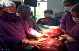 Cắt bỏ khối u khổng lồ nặng 9,5kg trong ổ bụng nam bệnh nhân