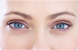5 cách khắc phục bọng mắt tại nhà