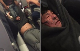 Vụ United Airlines kéo hành khách khỏi máy bay: Nguyên nhân do đâu?