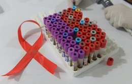 Lây nhiễm HIV/AIDS qua đường tình dục chỉ còn 5% nếu tuân thủ điều này
