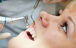 Có nên lấy cao răng thường xuyên?