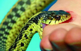 Đắp thuốc nam khi bị rắn cắn, bé 13 tuổi tử vong