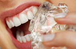 9 thói quen đang phá hỏng răng của bạn mỗi ngày