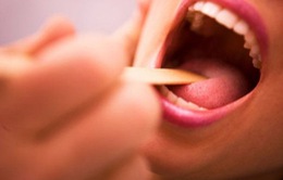 Viêm họng do vi khuẩn - Dùng thuốc gì?