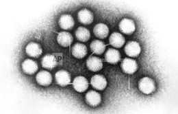 Virus hô hấp cấp tính khiến 9 trẻ em Mỹ thiệt mạng