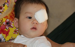 Thương thiên thần nhí 6 tháng tuổi phải bỏ con mắt vì ung thư võng mạc
