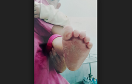 Gia đình bé gái 2 tuổi bị bỏng chân ở trường mầm non kêu cứu