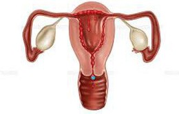 Độ dày niêm mạc tử cung ảnh hưởng tới khả năng có thai
