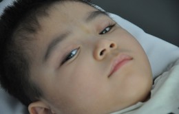 Ánh mắt cầu cứu sự sống của bé 3 tuổi bị viêm não