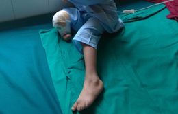 Nguy hiểm: một ca sinh tại nhà, trẻ bị cụt chân vì hội chứng hiếm gặp