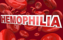 Hemophilia: bệnh cực kỳ nguy hiểm, gánh nặng lớn của xã hội
