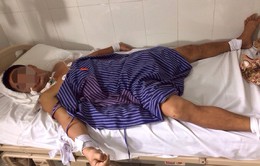Lạng Sơn: Bệnh nhân nhập viện do ong đốt gia tăng