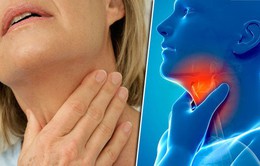 Nhận biết về bệnh ung thư vòm họng