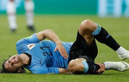 ĐT Uruguay lo sẽ mất "trọng pháo" trước trận tứ kết với ĐT Pháp