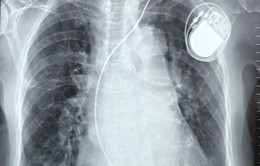 TP.HCM: Bệnh viện quận lần đầu cấy máy tạo nhịp tim cho bệnh nhân