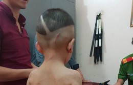 Bé trai 3 tuổi ở Phú Quốc bị cha dượng đánh thương tích 24%