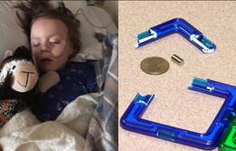 Bé trai 4 tuổi nhập viện trong tình trạng nguy kịch vì nuốt 13 viên nam châm