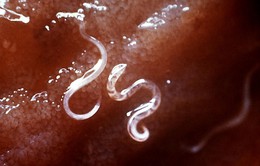 Tỷ lệ nhiễm ký sinh trùng tại Trung Quốc giảm mạnh nhờ nâng cấp hệ thống vệ sinh